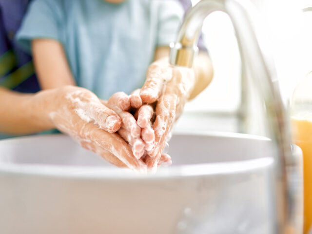 How Should You Treat Seborrheic Dermatitis